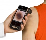 Handyscope: un dermatoscopio mvil que permite detectar el cncer de piel
