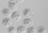Clulas madre: pilar bsico del proceso de renovacin celular