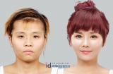Una joven coreana necesit nueve cirugas estticas para recuperar su aspecto femenino