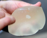 La FDA y los implantes mamarios de gel de silicona: informe de seguridad