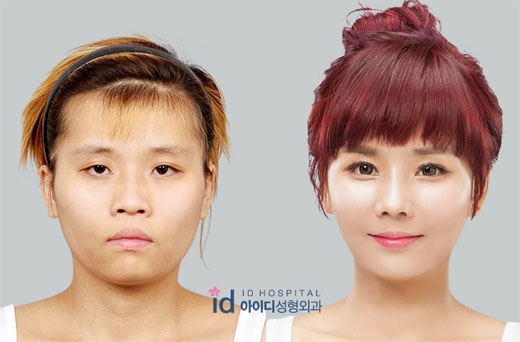 Una joven coreana necesitó nueve cirugías estéticas para recuperar su aspecto femenino