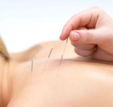 La acupuntura estética se suma a los tratamientos antiage